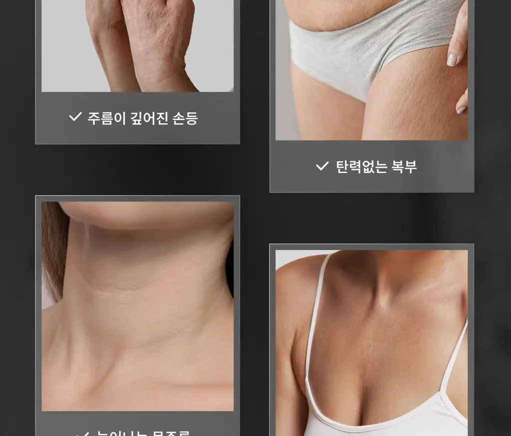 [탄력/목주름 개선] 힐그리즈 레티노이드 0.1% 퍼밍 바디 세럼 150ml 상세페이지 2